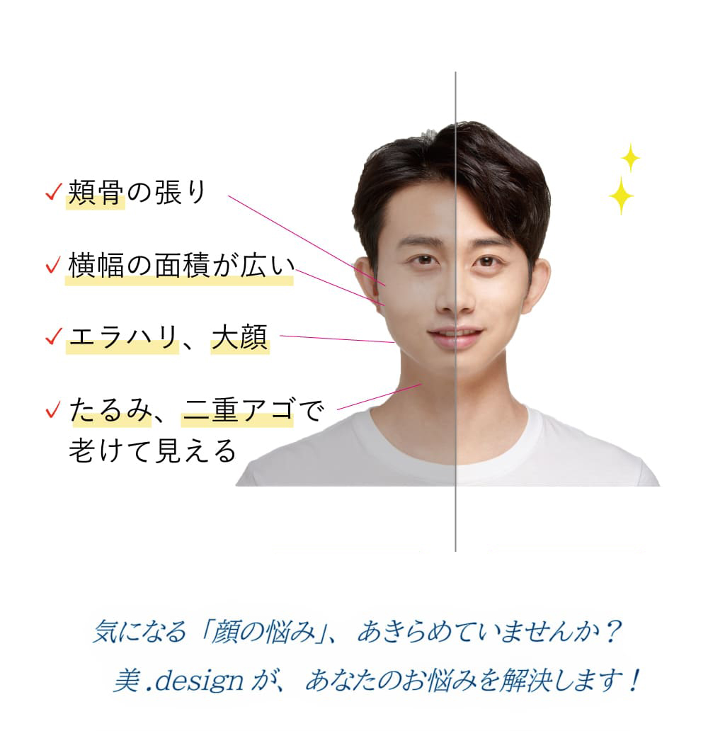 頬骨、横幅、エラ、大顔、たるみ、二重アゴ